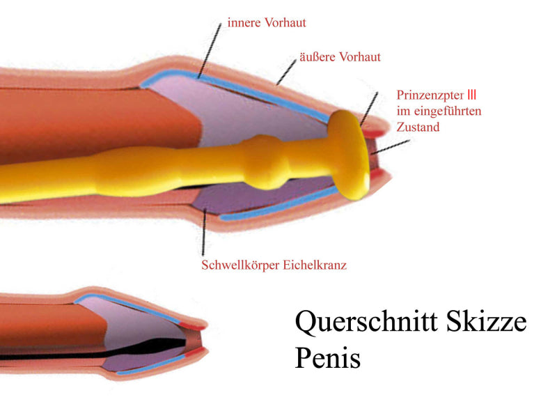 Harnröhren-Dildo aus Silikon, konzipiert für Dehnung und Stimulation; mit Olivenspitze zur intensiveren Empfindung. Anwendungsskizze.